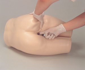 Modelo de Eliminación de Heces y Enema de Glicerina