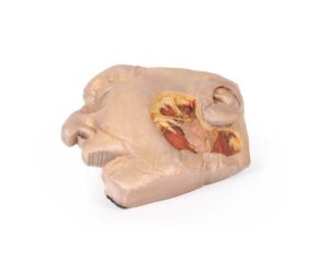 Modelo de Disección de Glándula Parótida y Nervio Facial