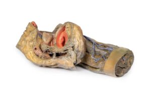 Modelo de Hemipelvis y Muslo Femenino