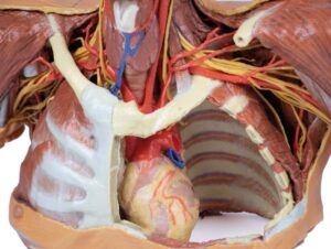 Modelo de Cabeza, Cuello y Hombro con Angiosomas
