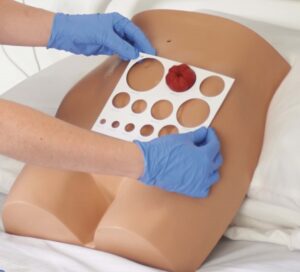 Torso para Cuidado de Estoma