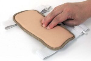 Simulador de Edema por Picaduras