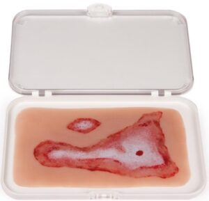 Moulage de Heridas "Escaldaduras"