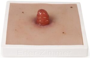 Moulage de Heridas Ileostoma - Soporte Incluido