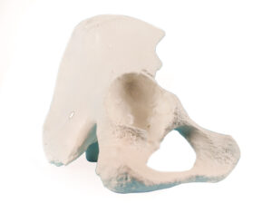 Modelo de Media Pelvis