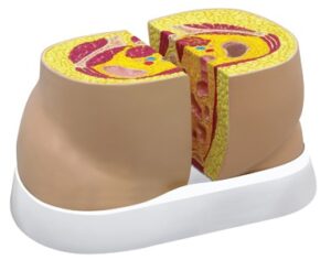 Modelo de Sección Transversal de Obesidad