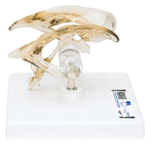 Modelo de Ventrículo Cerebral